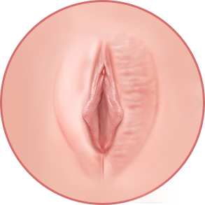 비대칭 / 비대한 대음순