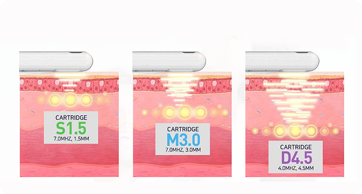 질쎄라의 원리