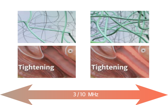 Volumetric Heating